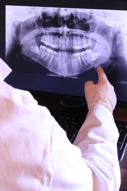Best Dental Abscess Treatment in Moss Beach, CA