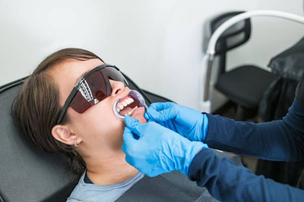 Best Emergency Wisdom Tooth Extraction in Moss Beach, CA